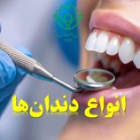 انواع دندان‌ها